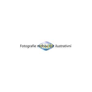 Drzak, Pricny stabilizator (SASIC 0945605) 7656931 Drzak, Pricny stabilizator (SASIC 0945605) 7656931